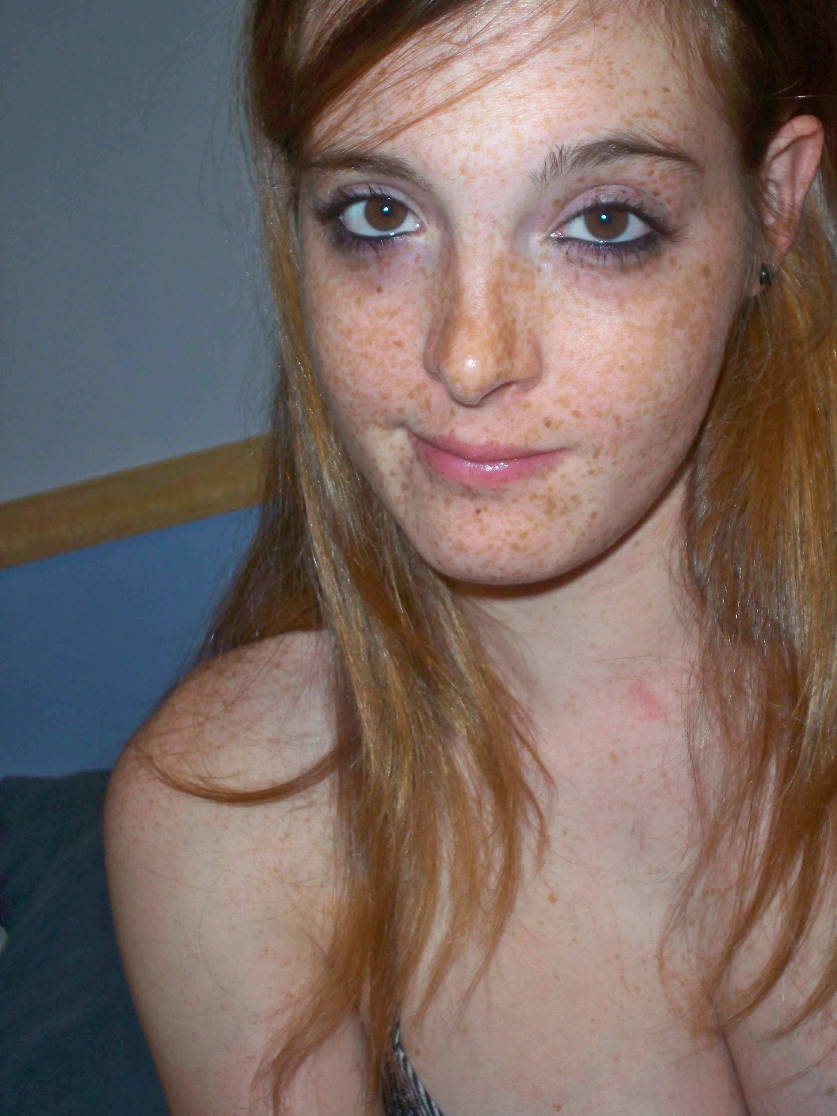 Freckles Porn Pics